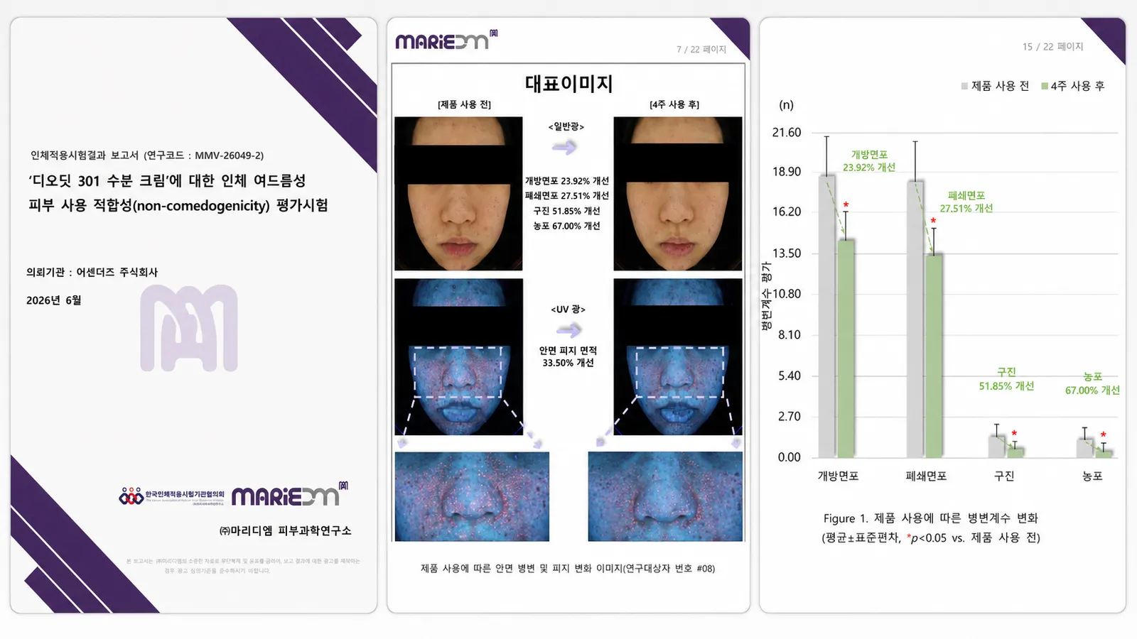 좁쌀여드름으로 불리는 폐쇄면포 — 디오딧 301 수분 크림, 인체적용시험에서 4주 후 27.51% 감소를 확인했습니다