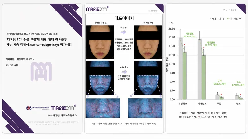 좁쌀여드름으로 불리는 폐쇄면포 — 디오딧 301 수분 크림, 인체적용시험에서 4주 후 27.51% 감소를 확인했습니다